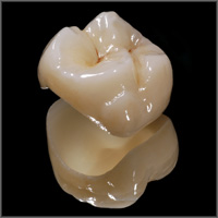 Dental Crowns - Hornsby Dental