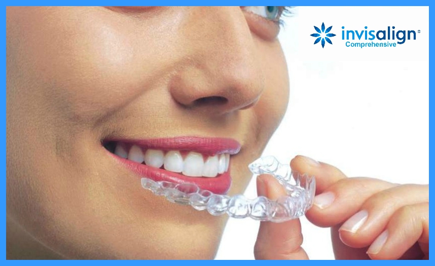 Invisalign Comprehensive