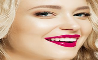 Dental Veneers at Hornsby