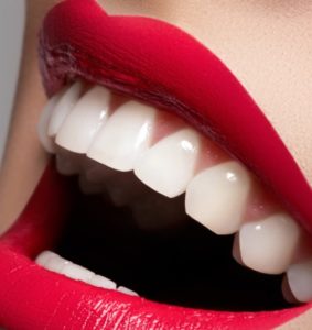 Teeth Whitening in Hornsby