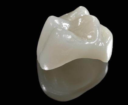 Why Do I Need A Crown For My Tooth?