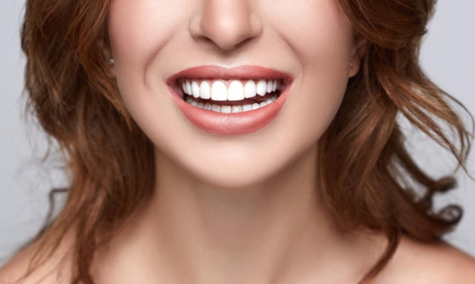 Porcelain Veneers