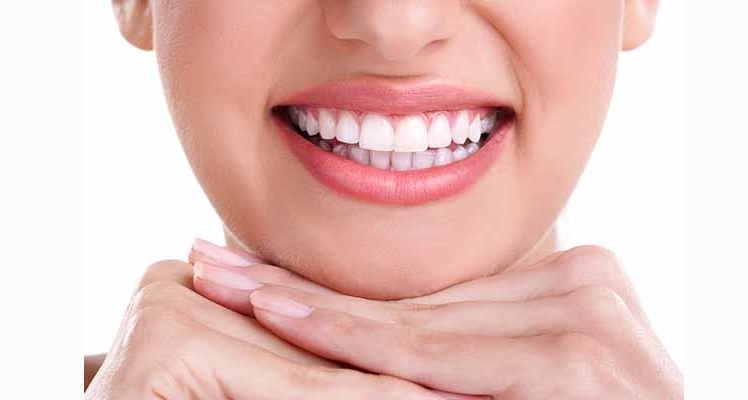 Teeth whitening Sydney