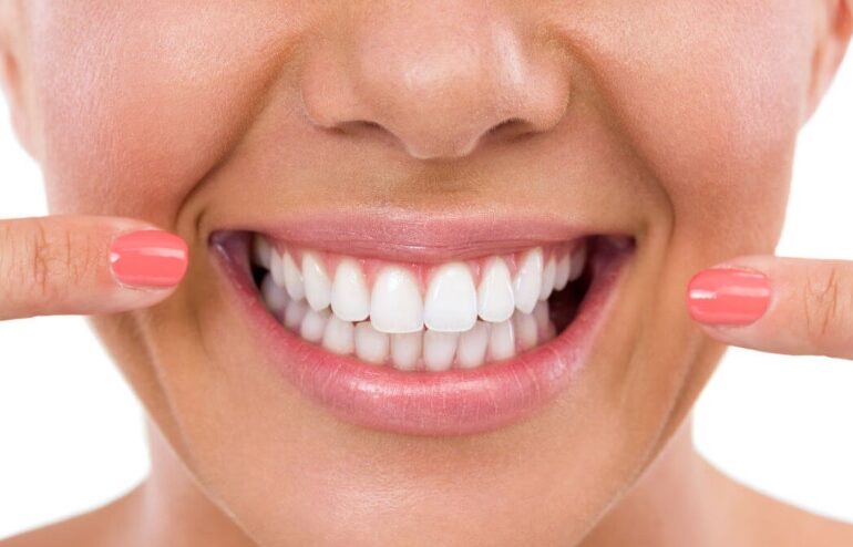 Teeth Whitening Price