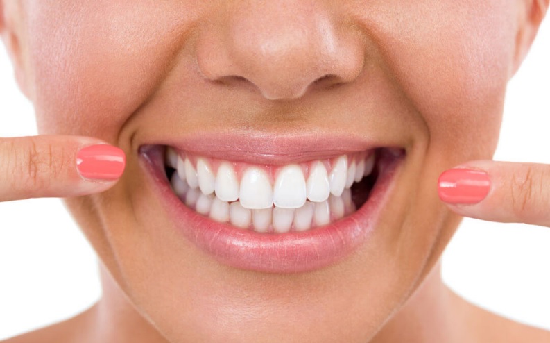 Teeth Whitening Price