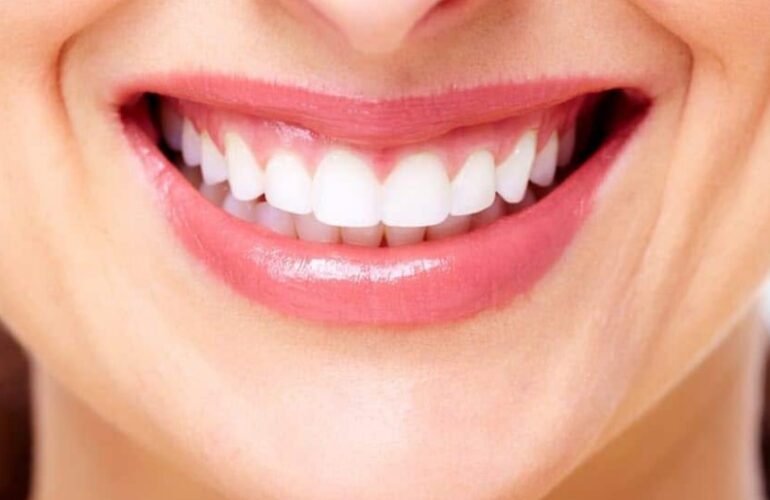 Teeth whitening Sydney