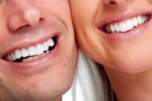 Teeth Whitening Price
