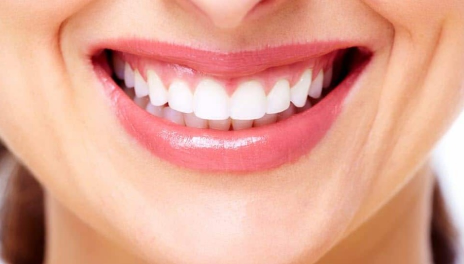 Teeth whitening Sydney