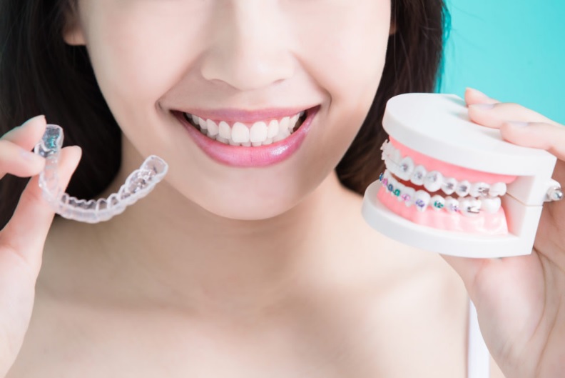 Invisalign vs Braces