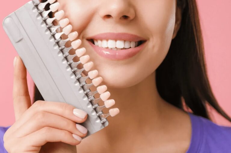porcelain veneers Sydney