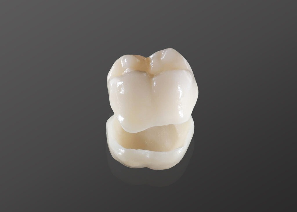 Restorative dental crown model