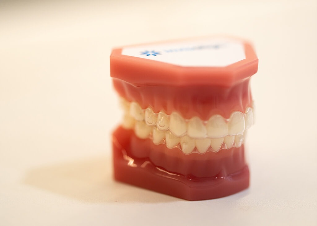 Invisalign clear aligners at Hornsby Dental