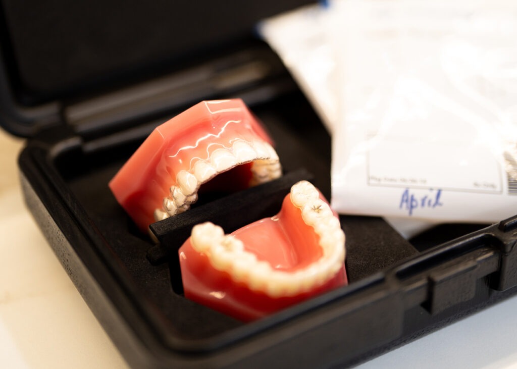Invisalign available at Hornsby Dental