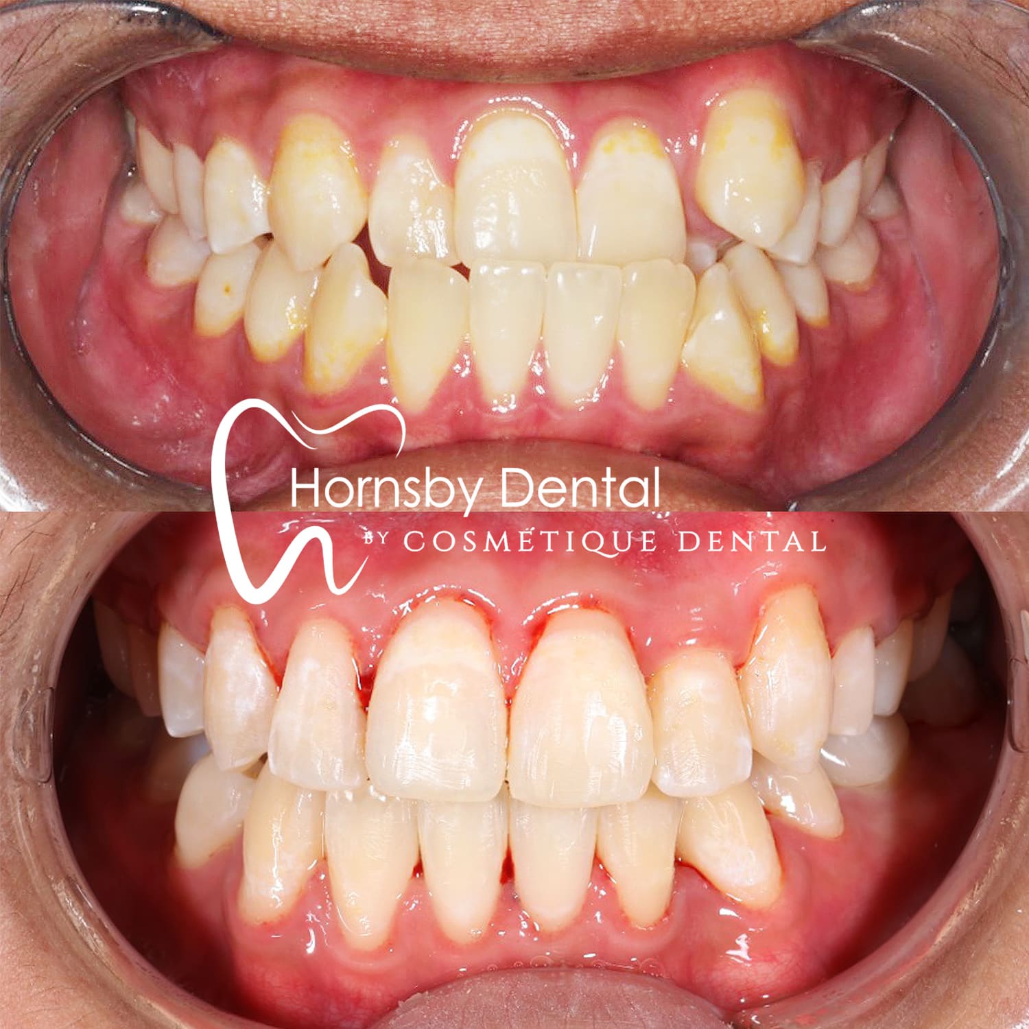Orthodontics