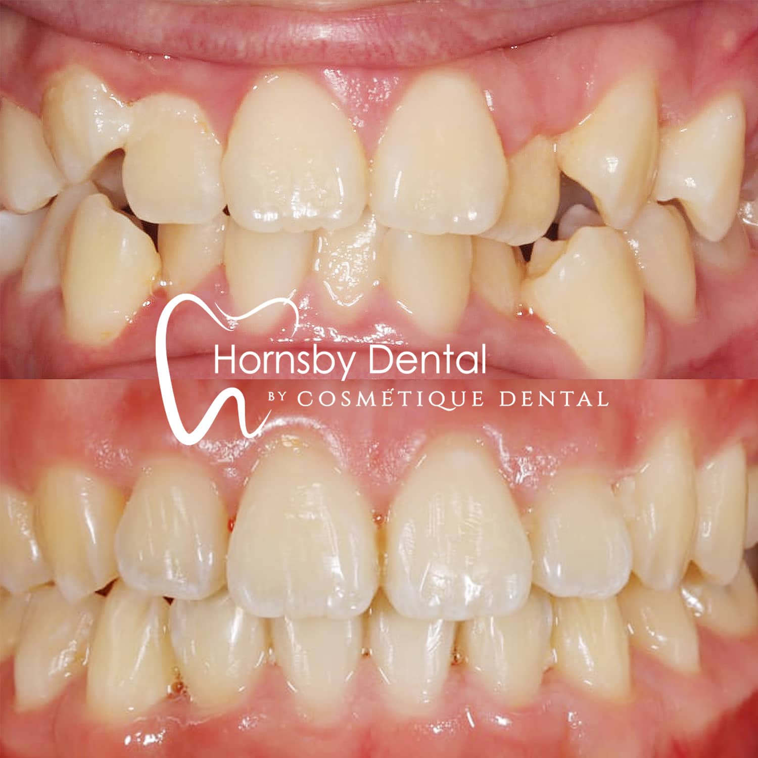 Orthodontics