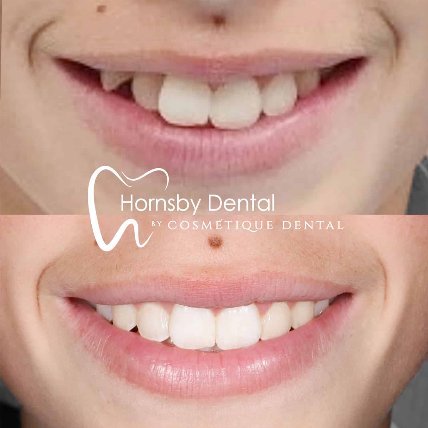 Orthodontics