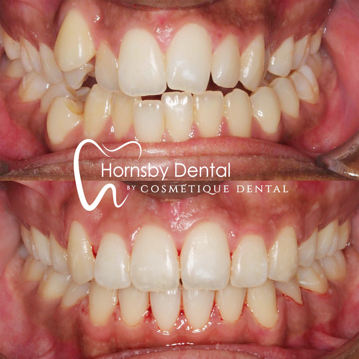 Orthodontics