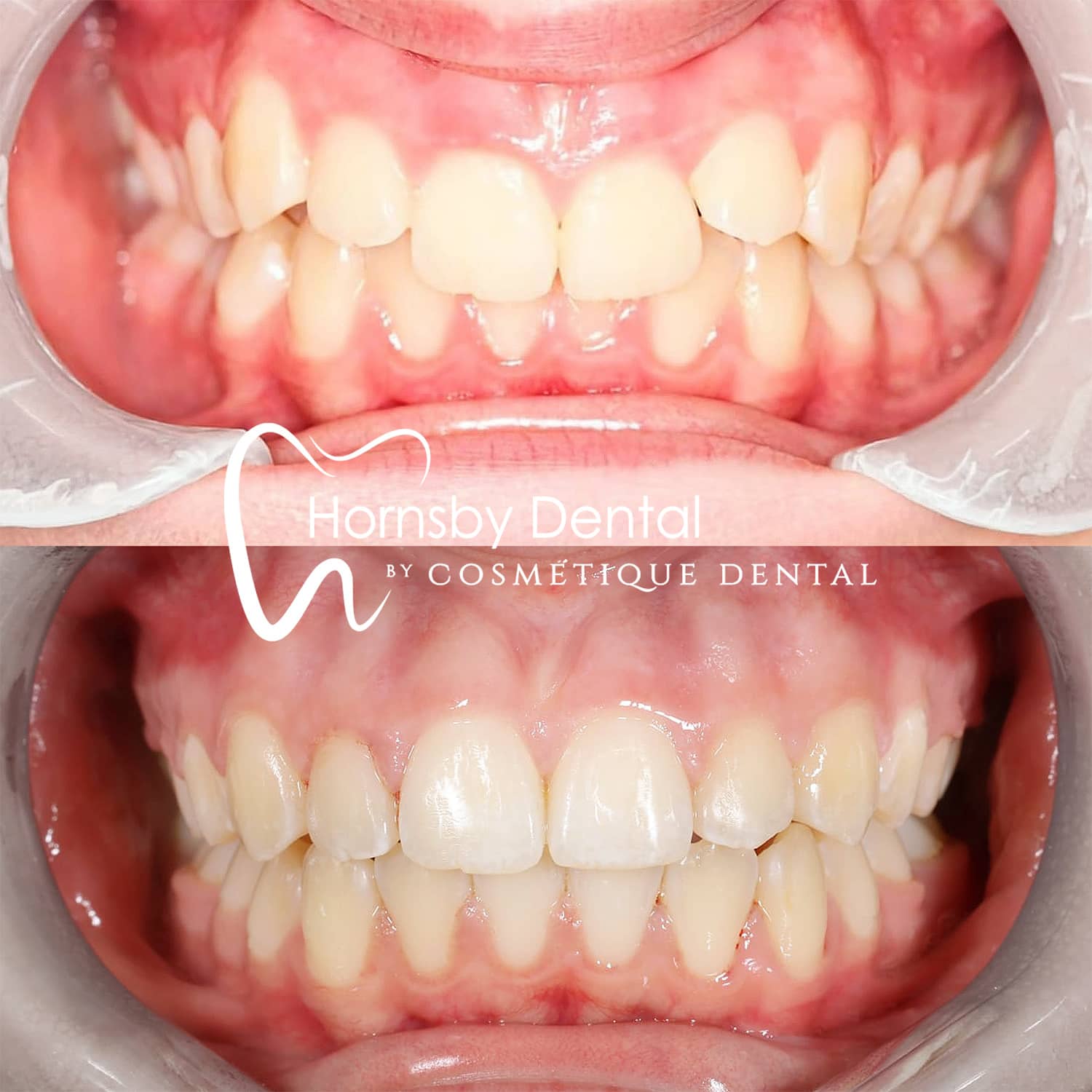 Orthodontics