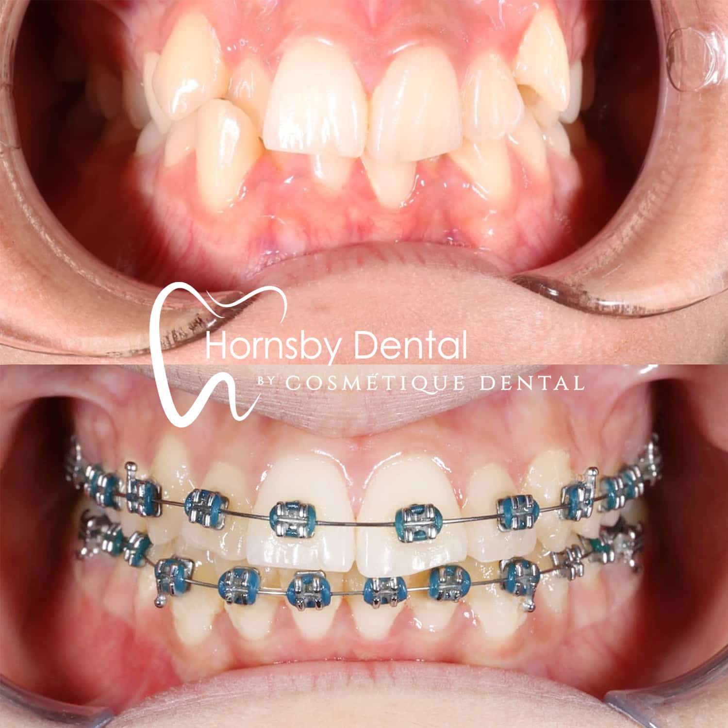 Orthodontics