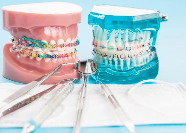 Orthodontic treatment at Hornsby Dental