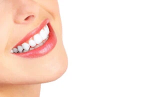 Hornsby Teeth Whitening